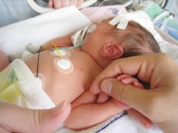 Community together — surprise and joy